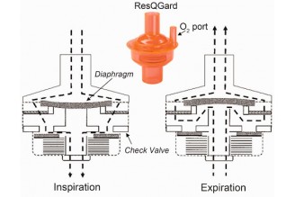 RFQ story between Buyer and China OEM ventilator diaphragm valve manufacturer
